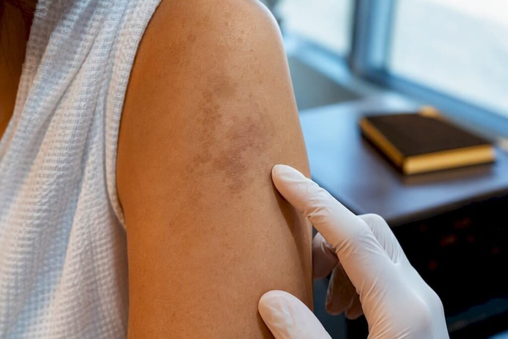 Médecin observant une tache pigmentaire sur la peau d'une patiente dans un centre laser